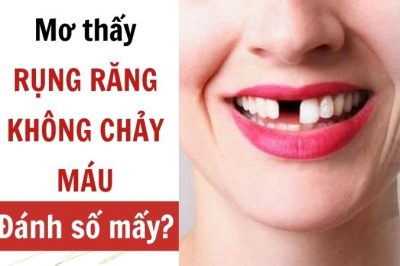 Mơ thấy rụng răng không chảy máu hên hay xui? Đánh lô con gì?