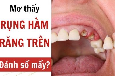 Chiêm bao thấy rụng hàm răng trên là điềm báo gì? Đánh số mấy?